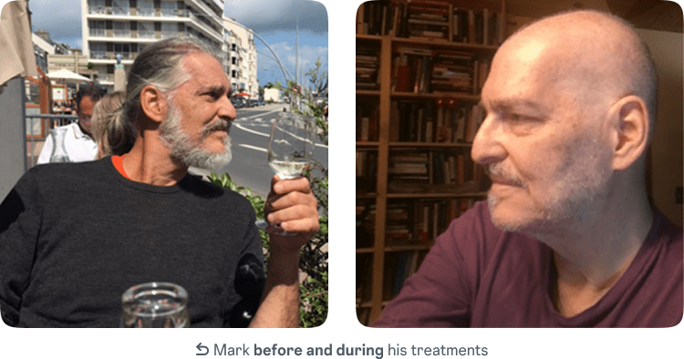 Mark before and during